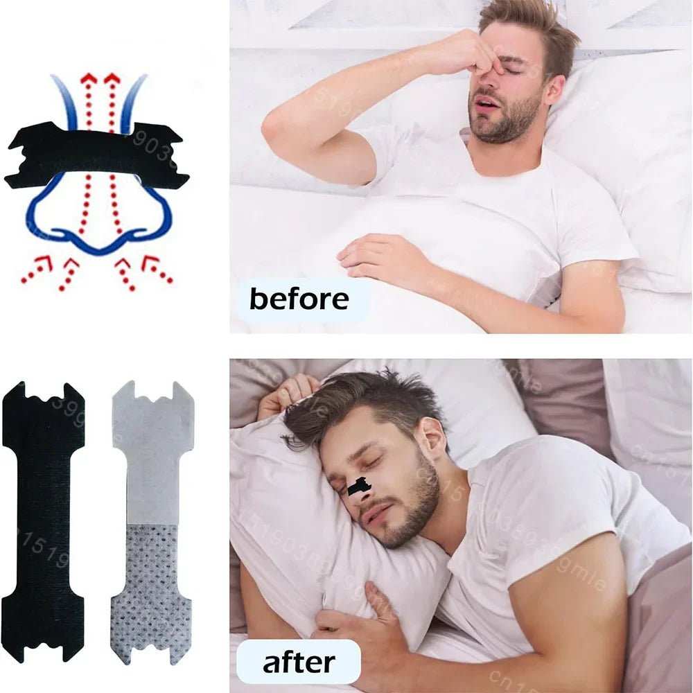 Anti-Snoring Nasal Strips